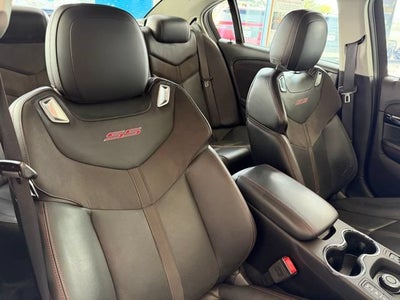 2017 Chevrolet SS NA